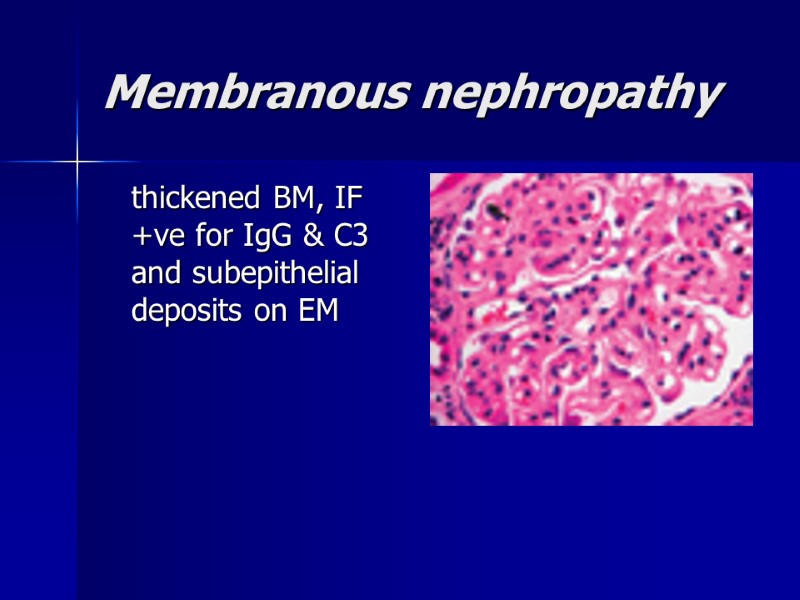 Membranous nephropathy   thickened BM, IF +ve for IgG & C3 and subepithelial